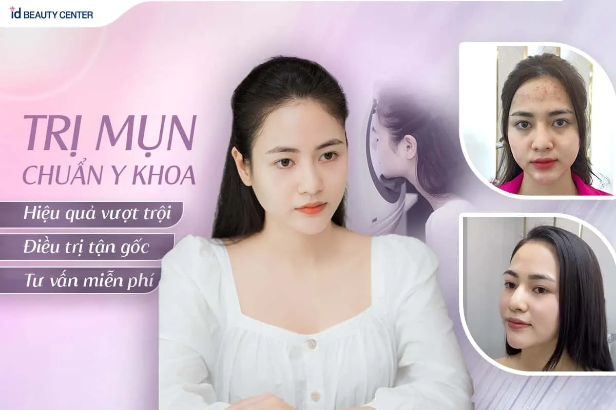 Phòng khám hay spa – chọn nơi nào để điều trị mụn?